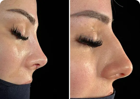 Natural Results Begin With Proper Aftercare